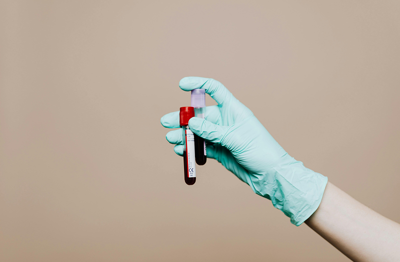 Blood Samples illustration